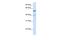 UDP Glucuronosyltransferase Family 1 Member A6 antibody, PA5-42009, Invitrogen Antibodies, Western Blot image 