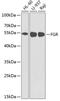 FGR Proto-Oncogene, Src Family Tyrosine Kinase antibody, 18-481, ProSci, Western Blot image 
