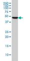 Tubulin Gamma 2 antibody, H00027175-M01, Novus Biologicals, Western Blot image 