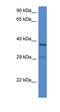 8-Oxoguanine DNA Glycosylase antibody, orb331128, Biorbyt, Western Blot image 