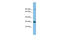 Chromatin Target Of PRMT1 antibody, ARP55300_P050, Aviva Systems Biology, Western Blot image 