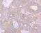 Huntingtin antibody, A00134-1, Boster Biological Technology, Immunohistochemistry paraffin image 