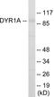 Dual specificity tyrosine-phosphorylation-regulated kinase 1A antibody, EKC1804, Boster Biological Technology, Western Blot image 