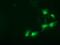 Sepiapterin Reductase antibody, MA5-25301, Invitrogen Antibodies, Immunocytochemistry image 