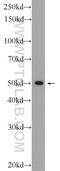 Zinc Finger Protein 101 antibody, 25599-1-AP, Proteintech Group, Western Blot image 