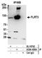 Fibronectin Leucine Rich Transmembrane Protein 3 antibody, A304-458A, Bethyl Labs, Immunoprecipitation image 