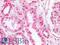 THO Complex 1 antibody, LS-B10873, Lifespan Biosciences, Immunohistochemistry paraffin image 