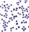 Interleukin 11 antibody, A01160-2, Boster Biological Technology, Immunocytochemistry image 