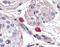 Fc Fragment Of IgE Receptor Ia antibody, 49-022, ProSci, Immunohistochemistry frozen image 