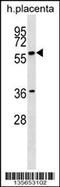GRB2 Associated Binding Protein 3 antibody, 58-446, ProSci, Western Blot image 