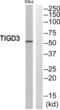 Tigger Transposable Element Derived 3 antibody, abx014948, Abbexa, Western Blot image 