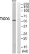 Tigger transposable element-derived protein 3 antibody, abx014948, Abbexa, Western Blot image 