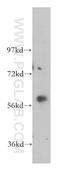 Putative glycerol kinase 3 antibody, 14176-1-AP, Proteintech Group, Western Blot image 