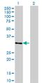 Zinc Finger Protein 397 antibody, MA5-22749, Invitrogen Antibodies, Western Blot image 