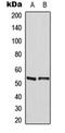 Myocyte Enhancer Factor 2A antibody, orb216153, Biorbyt, Western Blot image 