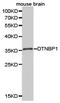 Dysbindin-1 antibody, LS-C192975, Lifespan Biosciences, Western Blot image 