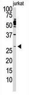 Dickkopf WNT Signaling Pathway Inhibitor 2 antibody, AP11553PU-N, Origene, Western Blot image 