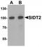 SID1 Transmembrane Family Member 2 antibody, TA319914, Origene, Western Blot image 