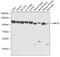 Ubiquitin Protein Ligase E3A antibody, GTX55832, GeneTex, Western Blot image 