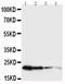 Growth Hormone 1 antibody, PA5-79307, Invitrogen Antibodies, Western Blot image 