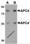 Anaphase Promoting Complex Subunit 4 antibody, 5725, ProSci Inc, Western Blot image 