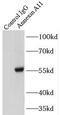 Annexin A11 antibody, FNab00428, FineTest, Immunoprecipitation image 