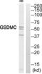 Gsdmc1 antibody, abx014576, Abbexa, Western Blot image 