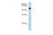 Pumilio RNA Binding Family Member 2 antibody, 29-424, ProSci, Western Blot image 