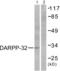 Protein Phosphatase 1 Regulatory Inhibitor Subunit 1B antibody, abx012746, Abbexa, Western Blot image 