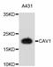 Caveolin 1 antibody, abx125305, Abbexa, Western Blot image 