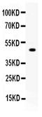 Carboxypeptidase B2 antibody, PB9998, Boster Biological Technology, Western Blot image 