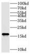 Tax1 Binding Protein 3 antibody, FNab08507, FineTest, Western Blot image 