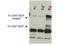 CD97 antigen antibody, A02982, Boster Biological Technology, Western Blot image 