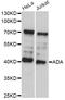 Adenosine Deaminase antibody, LS-C748929, Lifespan Biosciences, Western Blot image 