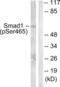 SMAD Family Member 1 antibody, abx012410, Abbexa, Western Blot image 