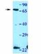 Cytochrome B-245 Beta Chain antibody, NBP1-59062, Novus Biologicals, Western Blot image 