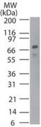 Tumor Protein P73 antibody, GTX13818, GeneTex, Western Blot image 