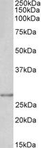 Snail Family Transcriptional Repressor 1 antibody, LS-B15180, Lifespan Biosciences, Western Blot image 