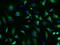 Signal Recognition Particle 72 antibody, GTX02276, GeneTex, Immunocytochemistry image 