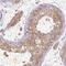 Cilia And Flagella Associated Protein 65 antibody, PA5-63075, Invitrogen Antibodies, Immunohistochemistry paraffin image 
