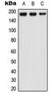 Latent Transforming Growth Factor Beta Binding Protein 1 antibody, LS-C354408, Lifespan Biosciences, Western Blot image 