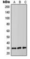 Catechol-O-Methyltransferase antibody, orb213766, Biorbyt, Western Blot image 