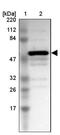 Tripartite Motif Containing 22 antibody, NBP1-81795, Novus Biologicals, Western Blot image 