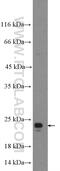 TIMP Metallopeptidase Inhibitor 1 antibody, 16644-1-AP, Proteintech Group, Western Blot image 