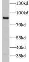 Integrin Subunit Beta 5 antibody, FNab04352, FineTest, Western Blot image 