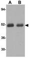 Caspase 2 antibody, GTX31699, GeneTex, Western Blot image 
