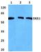 Sorting Nexin 1 antibody, A02692, Boster Biological Technology, Western Blot image 