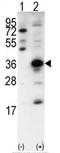 Snail Family Transcriptional Repressor 1 antibody, AP11935PU-N, Origene, Western Blot image 