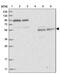 REC8 Meiotic Recombination Protein antibody, PA5-56836, Invitrogen Antibodies, Western Blot image 