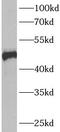 Ankyrin repeat and MYND domain-containing protein 2 antibody, FNab00403, FineTest, Western Blot image 